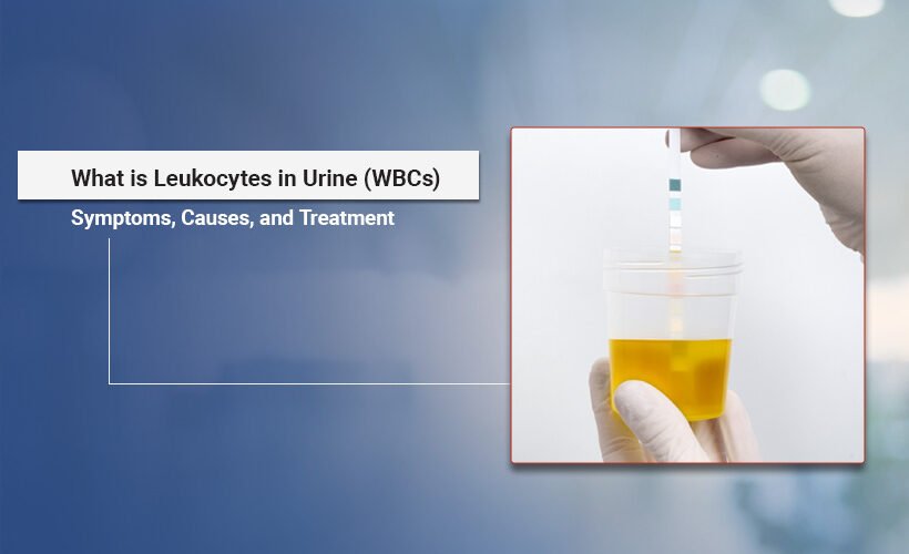 White blood cells in urine causes and treatment