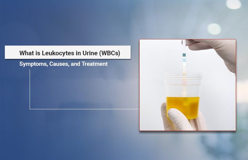 White blood cells in urine causes and treatment