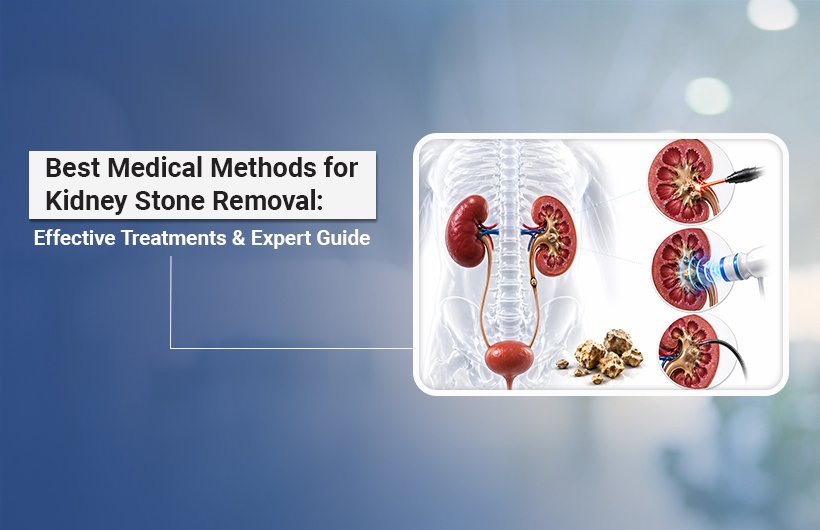 Best Medical Methods for Kidney Stone Removal