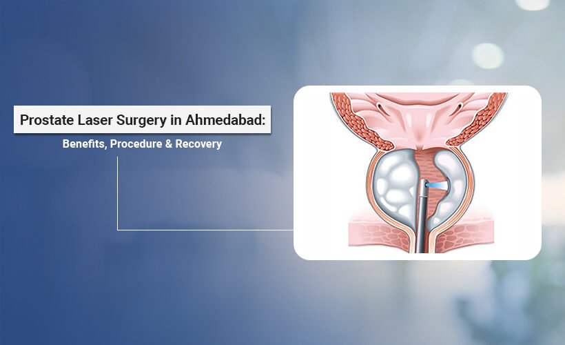Prostate Laser Surgery in Ahmedabad