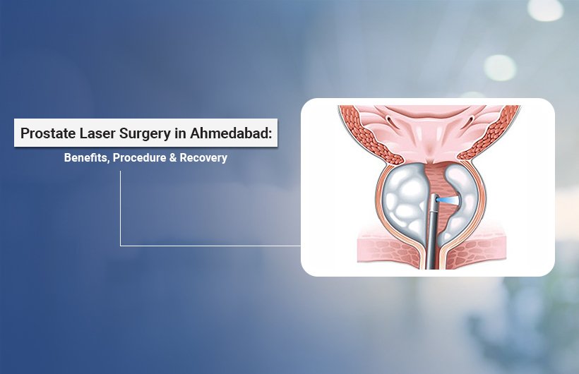 Prostate Laser Surgery in Ahmedabad