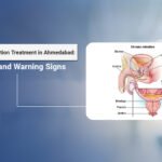 urinary retention treatment in Ahmedabad