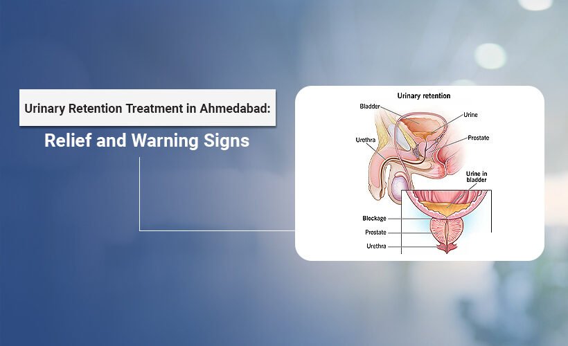 urinary retention treatment in Ahmedabad