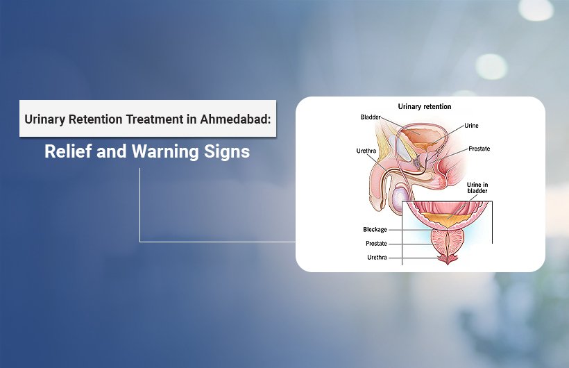 urinary retention treatment in Ahmedabad