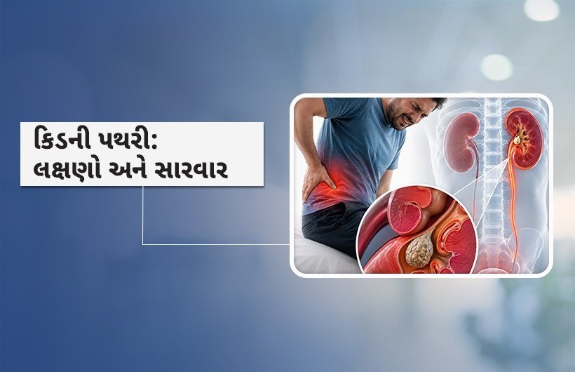 કિડની પથરી લક્ષણો અને સારવાર