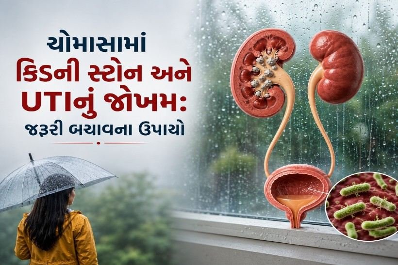 ચોમાસામાં કિડની સ્ટોન અને UTIનું જોખમ