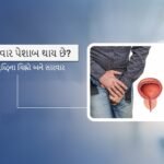પ્રોસ્ટેટ વૃદ્ધિની સારવાર પ્રોસ્ટેટ વૃદ્ધિની સારવાર